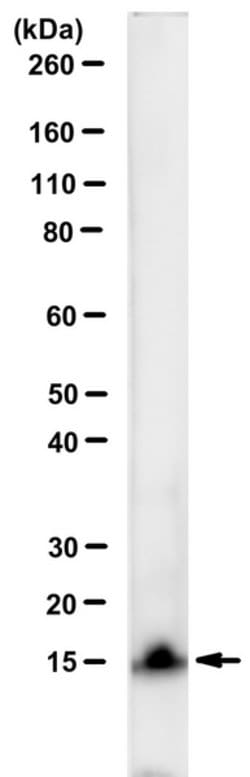 Chlamydial LPS, Mouse anti-Bacteria, Clone: EVI-H1, Millipore Sigma:Antibodies:Primary